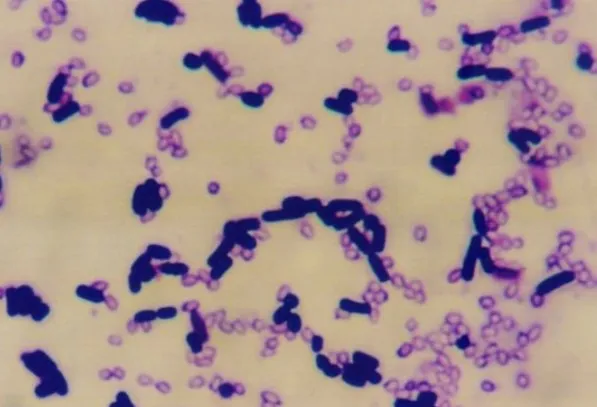 Agricultural Fertilizer Feed Use Probiotics Bacillus Pumilus Powder